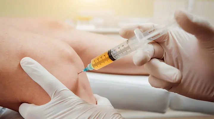 PRP مفاصل و زانو