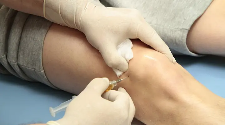 تزریق PRP زانو