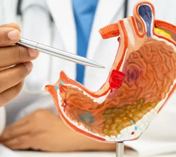 لاغری با بوتاکس معده